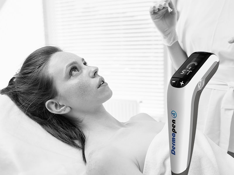 Microneedling (Dermapen) si Mezoterapie