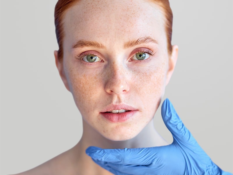 SCULPTRA